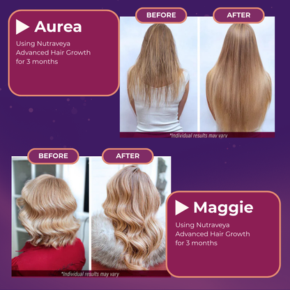 Nutraveya Advanced Hair Growth Vitamins