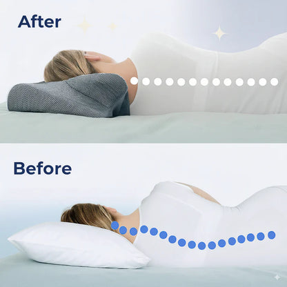 NutraEase™ Cloud Pillow for Neck Pain & Snoring Relief